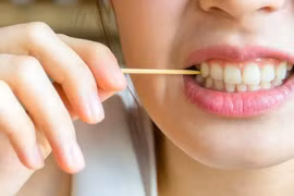 Chăm vệ sinh răng mà vẫn sâu