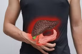 Phương pháp điều trị ung thư gan