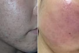 Biến thành bà lão vì thuốc dị ứng