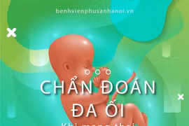 Nguyên nhân gây đa ối 