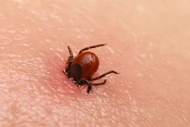 Sốt xuất huyết bọ chét có thể gây tử vong tới 40%