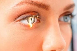 Ai cũng có nguy cơ mắc glocom