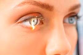 Ai cũng có nguy cơ mắc glocom