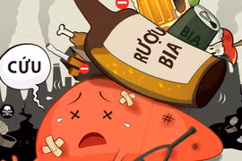 Uống rượu hay uống bia thì đều có nguy cơ mắc các bệnh ung thư dưới đây