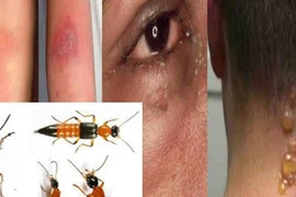 Độc tố kiến ba khoang độc hơn nọc rắn, cẩn thận xử lý kẻo rước hoạ vào thân