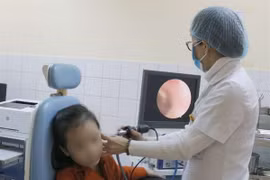 Hạt cườm chui tọt vào tai