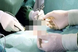 Ung thư dương vật biểu hiện giống bệnh hoa liễu