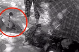 Người phụ nữ bị gãy gập chân vì áo chống nắng cuốn vào bánh xe máy