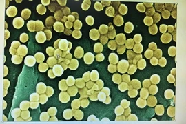 Người bị viêm họng, viêm xoang chế biến thực phẩm có thể gây ngộ độc