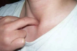 Day bấm huyệt hỗ trợ trị hen phế quản