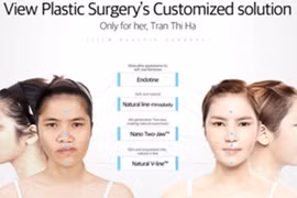 Choáng với tài “dao kéo” của ê kíp bác sĩ Let Me In vừa sang Việt Nam