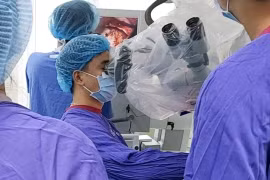 Vi phẫu tách mạch máu chữa đau nửa mặt.