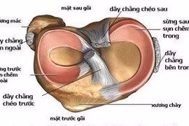 Rách sụn chêm khớp gối 