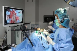 Phẫu thuật u tuyến yên có chữa khỏi bệnh to đầu chi?