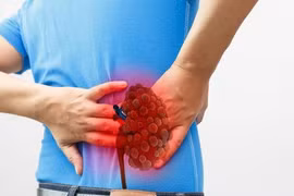 Người bị suy thận có thể sống được bao lâu?