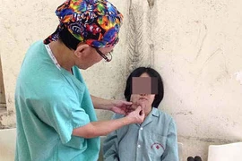 U sợi thần kinh gây biến dạng cơ thể