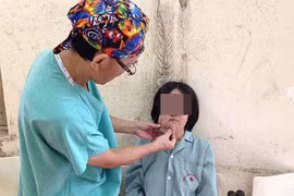 U sợi thần kinh gây biến dạng cơ thể