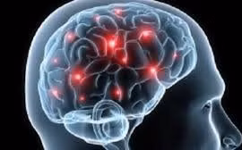 Sa sút trí tuệ đa nhồi máu