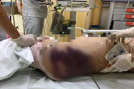 Không đủ quan tâm cũng là một dạng ngược đãi