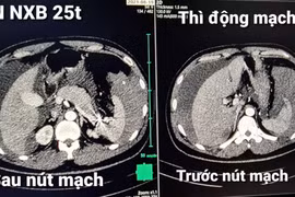 Rối loạn đông máu cần đến viện ngay
