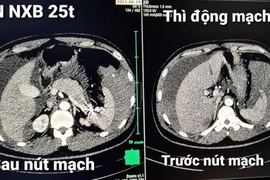 Rối loạn đông máu cần đến viện ngay
