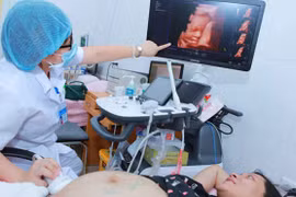 Bà bầu siêu âm nhiều có gây hại cho thai nhi?