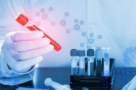 Ung thư quan trọng là xét nghiệm sớm 