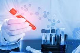 Ung thư quan trọng là xét nghiệm sớm 