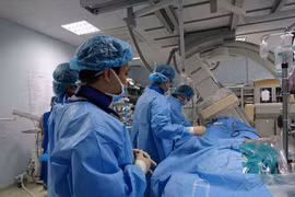 Điều trị rung nhĩ bằng sóng cao tần