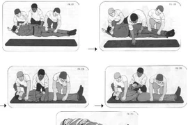 Liệt cả người vì xử lý sai