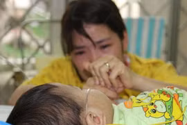 Cục trưởng Cục Y tế dự phòng: Phòng bệnh sởi cách duy nhất là tiêm vắc xin