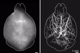 Kính hiển vi mới tiếp cận sâu hơn vào não sống