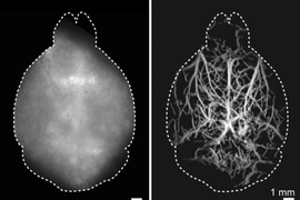 Kính hiển vi mới tiếp cận sâu hơn vào não sống