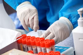 Hà Nội có 6 ca F0, 5 ca thuộc ổ dịch BV Hữu nghị Việt Đức