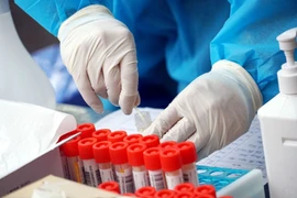 Hà Nội có 6 ca F0, 5 ca thuộc ổ dịch BV Hữu nghị Việt Đức