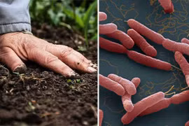 Cách phòng tránh bệnh Whitmore