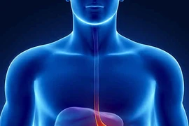 Bác sĩ Singapore “biến” ruột non thành dạ dày cho bệnh nhân ung thư