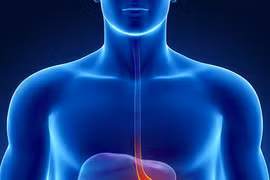 Bác sĩ Singapore “biến” ruột non thành dạ dày cho bệnh nhân ung thư