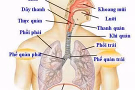 Gắp thành công đoạn dây thép trong họng bệnh nhân 
