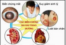 Cách theo dõi để tránh biến chứng do tiểu đường