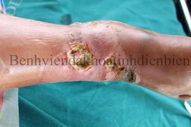 Điều trị ngứa tại nhà thành ra bệnh nặng