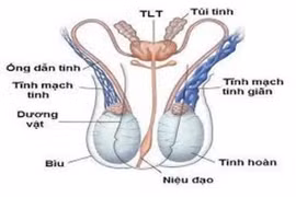 Xử lý giãn tĩnh mạch tinh