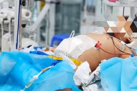 Nguyên nhân khiến nhiều ca sốt xuất huyết trở nặng 