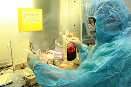 Điều trị bệnh Thalassemia bằng tế bào gốc