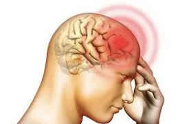 Phát hiện sớm u não