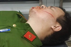 Hai cảnh sát bị chém khi làm nhiệm vụ