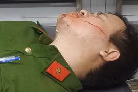 Hai cảnh sát bị chém khi làm nhiệm vụ