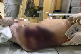 Vụ cháu bé 8 tuổi bị mẹ kế bạo hành: Mẹ đẻ ngất xỉu khi nghe tin, đau đớn nhìn con trong linh cữu