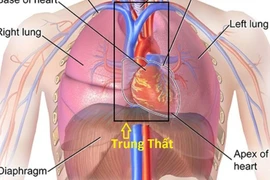 U trung thất ở nhiều vị trí khác nhau