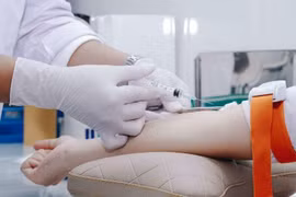 Xét nghiệm máu chẩn đoán ung thư trong 30 phút